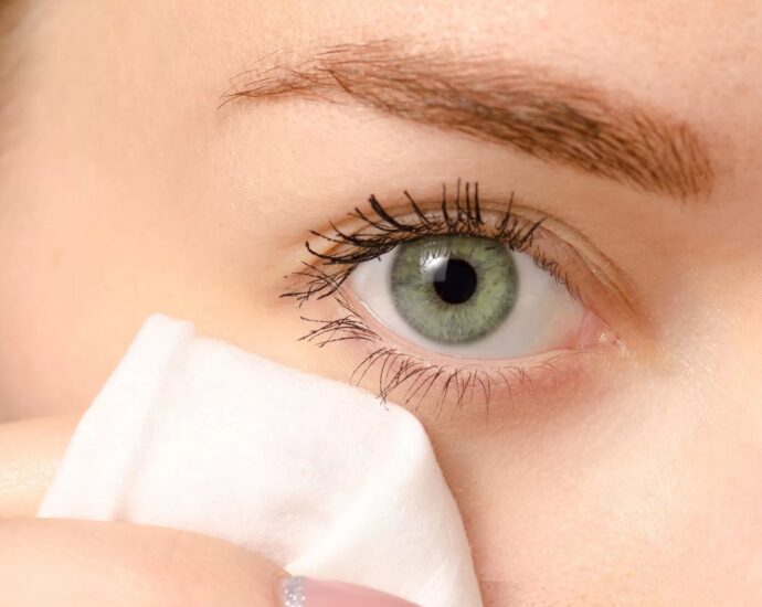 Skin Care - Home Remedies To Remove Dark Circles