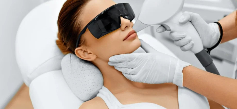 laser hair removal